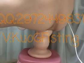 业余中国男孩用拳头探索极端脱垂 gay chinese couple porn