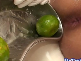 年轻的亚洲患者会对肛门柠檬恋物癖感到惊讶 gay chinese amateur porn