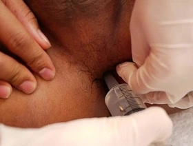 泰国twinks被角质医生检查 japan nonke gay porn